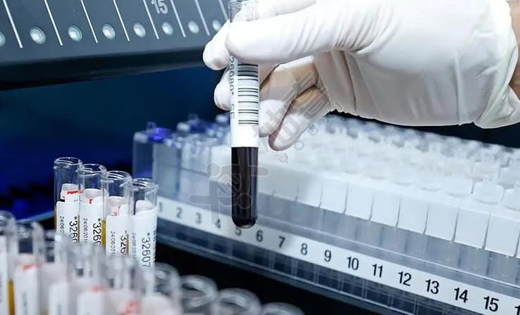试管婴儿用谁的精子？医院做试管会弄错精子么？